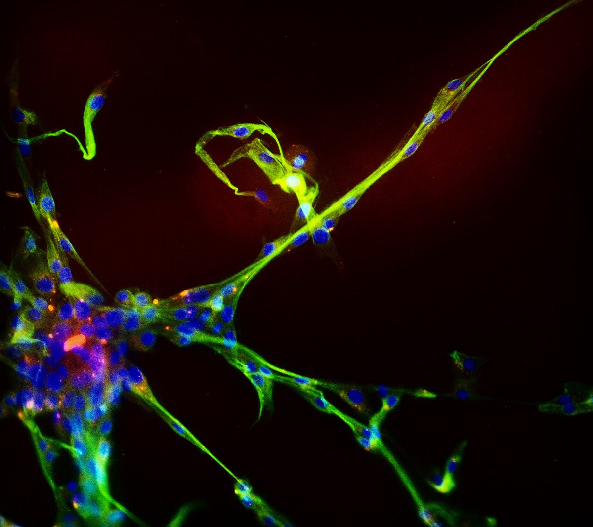 And there’s my pink Cy3-labeled oligo that I synthesized and posted about a while ago! These are actually brain cells that I transfected, stained, and viewed under a fluorescence microscope. My oligos are the pink dots against the green (cytoplasm) and blue (nucleus) background.