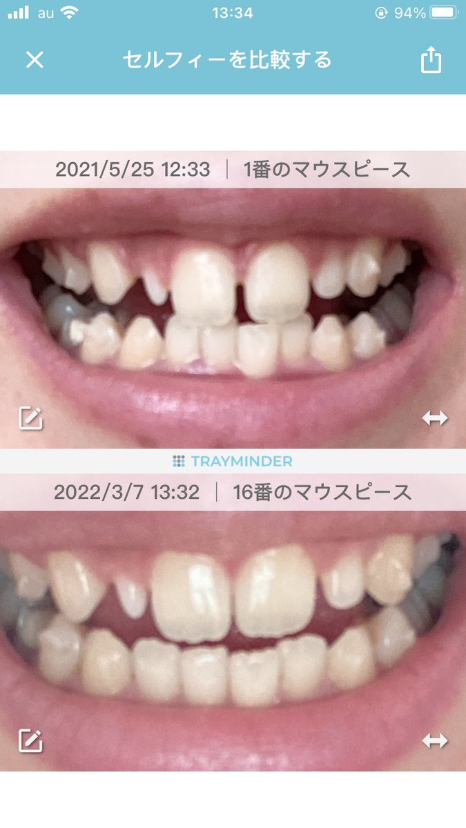 pcpph8888's tweet photo. 去年の5月と今！
こうして写真並べると動いてるの実感できる…☺️✨ https://t.co/hSlOxpK5lC