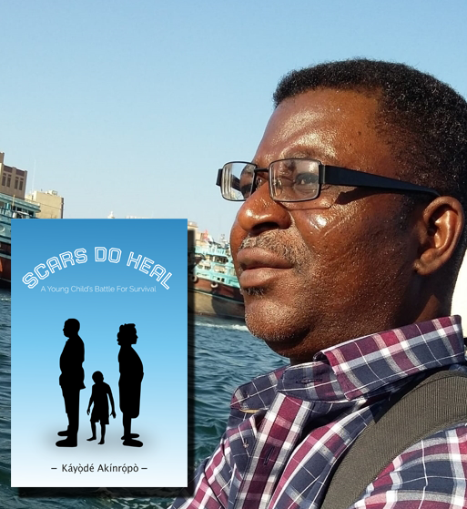 OptimalpathCon's tweet photo. Authors Week! 📚📖🎉🎉🎉🎉🎉
Today,  we are commemorating Kayode Akinropo, author of Scars Do Heal.
You can find his book and more at: https://t.co/pCP9zsKbEJ
or on Amazon at:
https://t.co/QWzddpqdwn

#authorsweek #writer #novel #publishing  #novel #optimalpath #bookmonth https://t.co/tWzwAPehs8