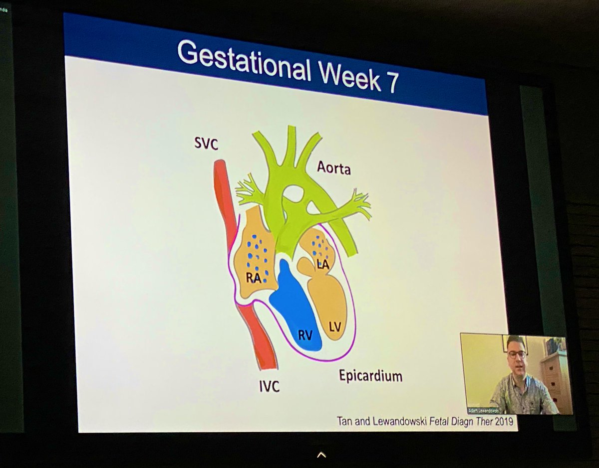 Fatima Crispi (@fatimacrispi) on Twitter photo Fantastic start of the day with @DrAJLewandowski talking about the transition from #embryonic #fetal and #neonatal #heart and #prematurity
Postgraduate #FetalCardiology <a href="/UniBarcelona/">Universitat de Barcelona</a> <a href="/medfetalBCN/">Fetal Medicine Barcelona</a> <a href="/OxfordCCRF/">Oxford CCRF</a> Fantastic start of the day with @DrAJLewandowski talking about the transition from #embryonic #fetal and #neonatal #heart and #prematurity
Postgraduate #FetalCardiology <a href="/UniBarcelona/">Universitat de Barcelona</a> <a href="/medfetalBCN/">Fetal Medicine Barcelona</a> <a href="/OxfordCCRF/">Oxford CCRF</a>