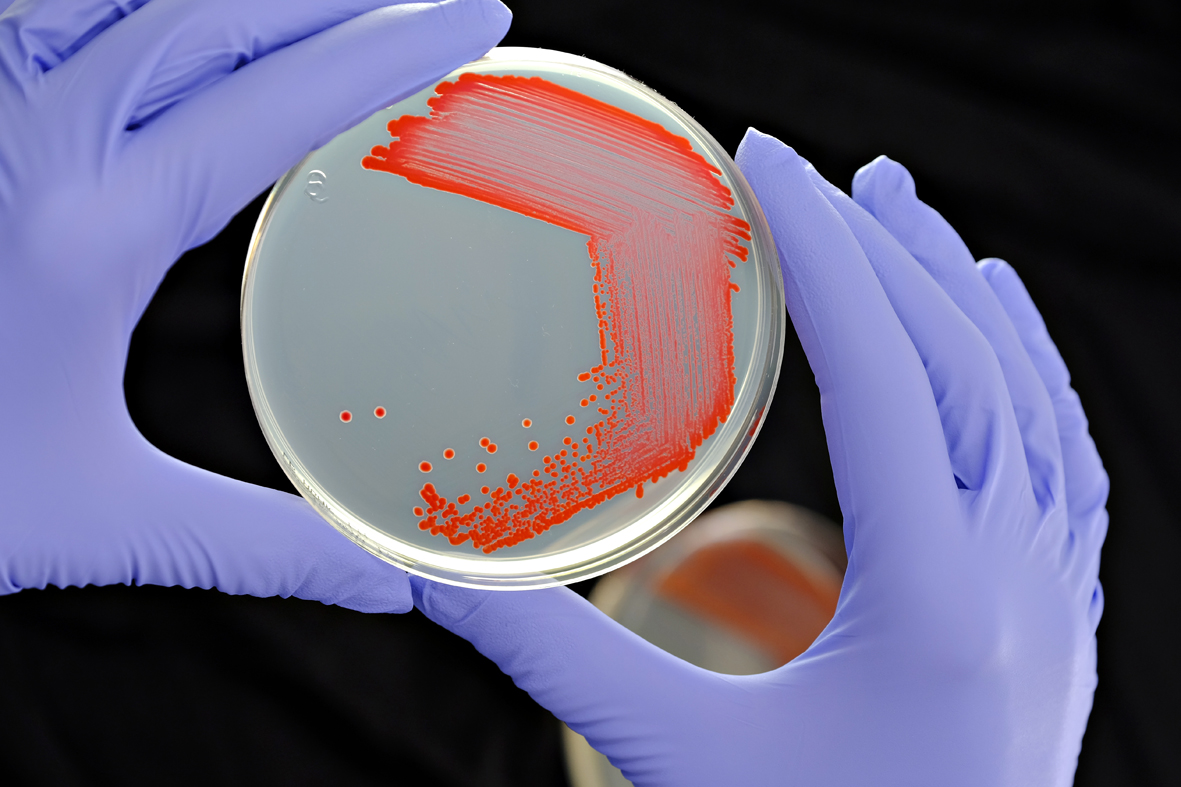Sarah Coulthurst (@sarahcoulthurs1) on Twitter photo We are looking for a group leader to join the Division of Molecular Microbiology <a href="/UoDLifeSciences/">UoD Life Sciences</a> at Senior Lecturer/Reader level. We value scientific excellence and a supportive, diverse community and provide an outstanding environment to foster both.
bit.ly/34obVTD We are looking for a group leader to join the Division of Molecular Microbiology <a href="/UoDLifeSciences/">UoD Life Sciences</a> at Senior Lecturer/Reader level. We value scientific excellence and a supportive, diverse community and provide an outstanding environment to foster both.
bit.ly/34obVTD