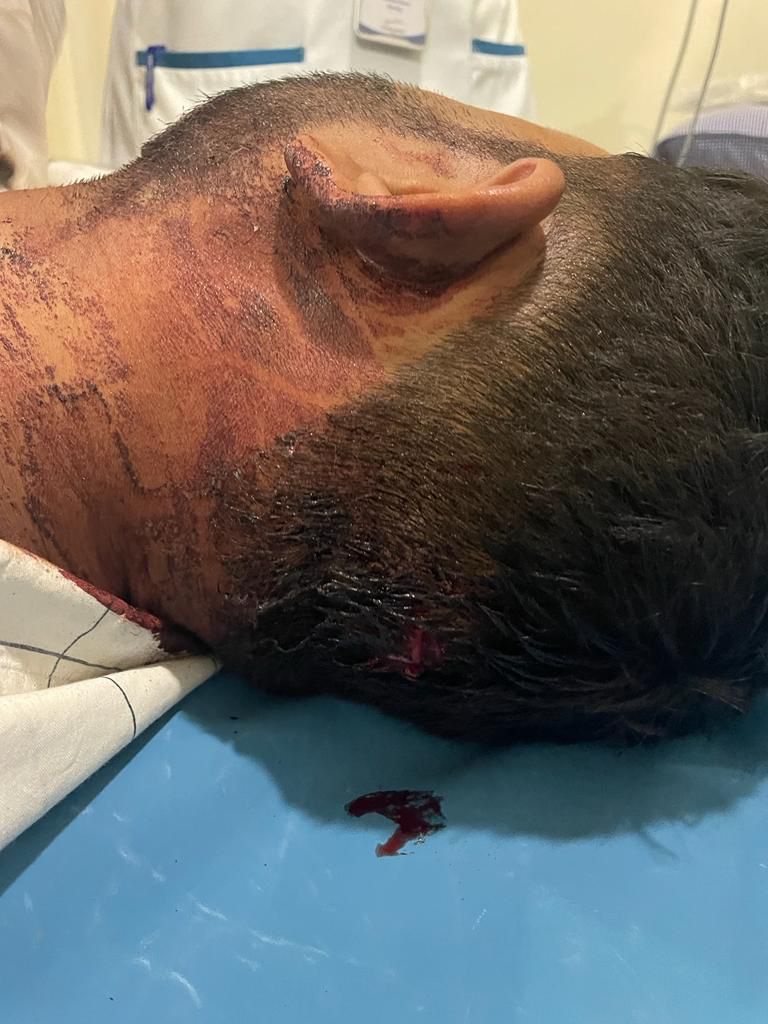 Shubham_Jadhav3's tweet image. वाळूज पोलिस स्टेशन हद्दीत कंप्युटर इंजिनिअरचे अपहरण करून जीवंत मारण्याचा प्रयत्न, तरीही आरोपी मोकाट
#noActiontaken #cpAurangabadpolice
@OfficeofUT @Dwalsepatil @AbadCityPolice @AjitPawarSpeaks @Dev_Fadnavis @DGPMaharashtra @CMOMaharashtra @mygovMaha