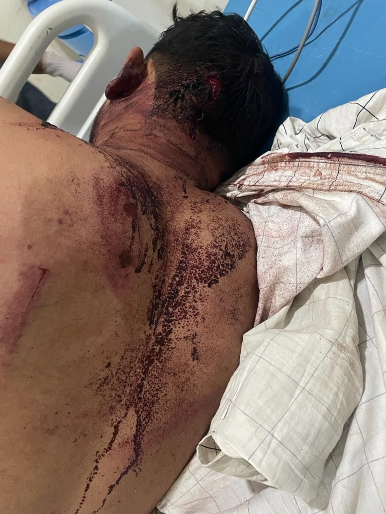 Shubham_Jadhav3's tweet image. वाळूज पोलिस स्टेशन हद्दीत कंप्युटर इंजिनिअरचे अपहरण करून जीवंत मारण्याचा प्रयत्न, तरीही आरोपी मोकाट
#noActiontaken #cpAurangabadpolice
@OfficeofUT @Dwalsepatil @AbadCityPolice @AjitPawarSpeaks @Dev_Fadnavis @DGPMaharashtra @CMOMaharashtra @mygovMaha