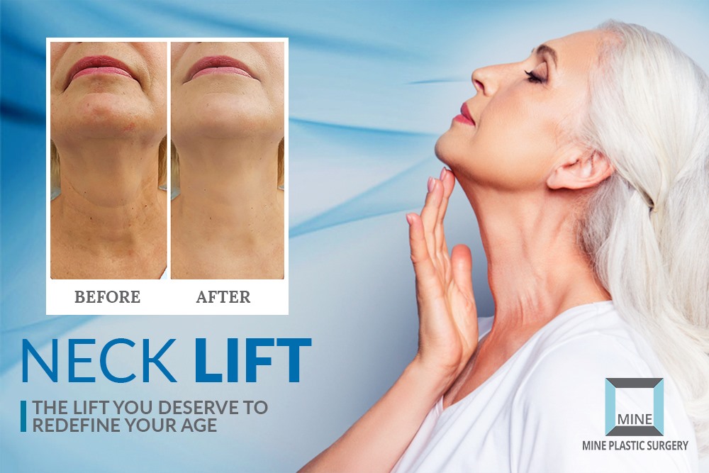 "Find your hidden beauty through Neck lifting"
Neck lifting is a process of removing extra fatty skin and  muscles from the neck and jaw line by the surgery which unlock your inner beauty.
✔ 𝐄𝐦𝐚𝐢𝐥: info@mineclinic.com
#Neckliftsurgery #Koreanneckliftingsurgery #Necksurgery