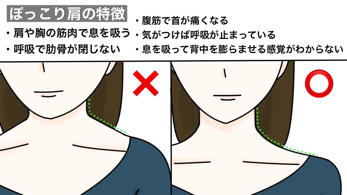 水泳とかやってた？と言われてしまうぽっこり肩の原因と対策！