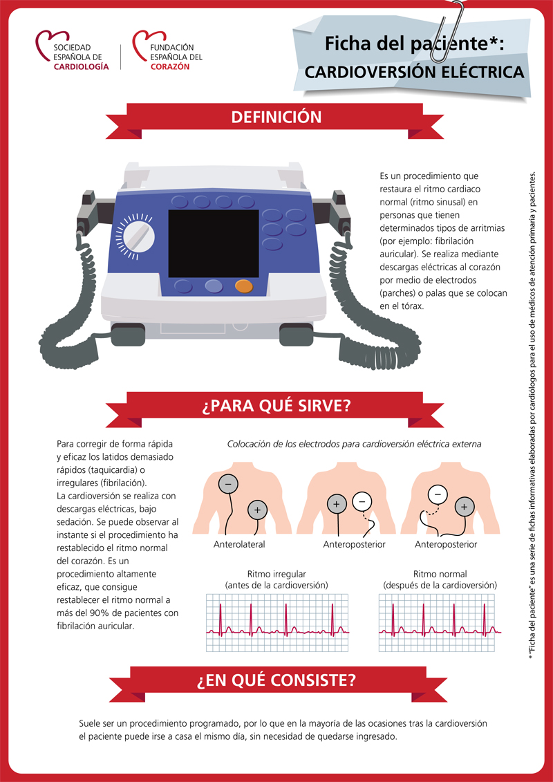 La cardioversión es un procedimiento que restaura el ritmo cardiaco normal en personas con determinadas arritmias. Te hablamos de ello en una de nuestras fichas del paciente: fundaciondelcorazon.com/corazon-facil/…