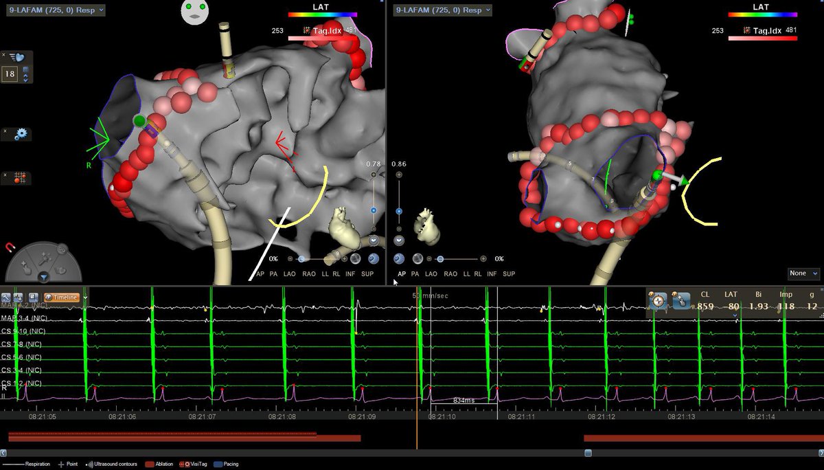 Scott J. Greenberg, MD, FHRS tweet media