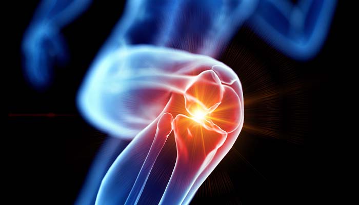 How can #gastroenterologists &amp; #rheumatologists work together to detect &amp; manage #IBD-associated #arthritis? <a href="/FITWITMD/">Neilanjan Nandi, MD, FACG, AGAF, FCCF, FACP</a> &amp; Dr. Sergio Schwartzman share their insights: bit.ly/3HBxnSE #RheumTwitter #GIInsights