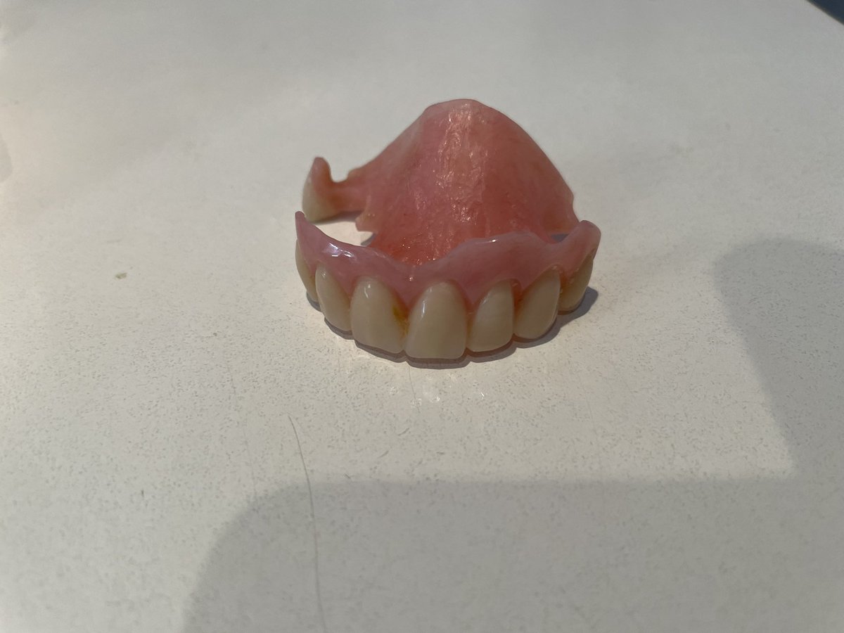 RedmondCare's tweet photo. Dentures are no fun!

From this to this…..

A removable, loose denture to a fixed solid implant bridge. Basically, it’s like having your teeth back. ☺️

#dentalimplants #dentalbridgework #smilemakeover https://t.co/zng9SoaTth