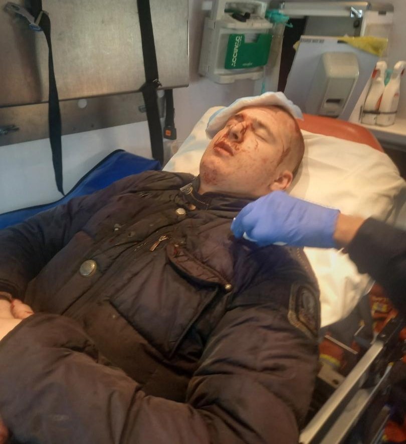 PF_Benedetti's tweet photo. Mon neveu J-Claude, 16 ans, a été atteint d'un tir de flash ball à Aiacciu. Il a reçu des coups de pieds dans la tête et à la gorge.
Le nouveau @Prefet2A nous montre sa conception du dialogue: En faisant frapper des manifestants ou non manifestants et en mettant des vies en jeu. https://t.co/MhJbJxyE9D