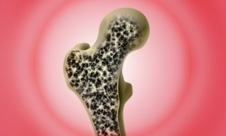 Spire_Learning's tweet image. Earn #CME credit by learning what you need to know to screen, diagnose, &amp;amp; treat patients with #osteoporosis!

bit.ly/3qatC0L

#twitterMed #MedEd #medicaleducation #primarycare #PCP #gynecologists #endocrinologists #rheumatologists #orthopedists #orthopedics #bone