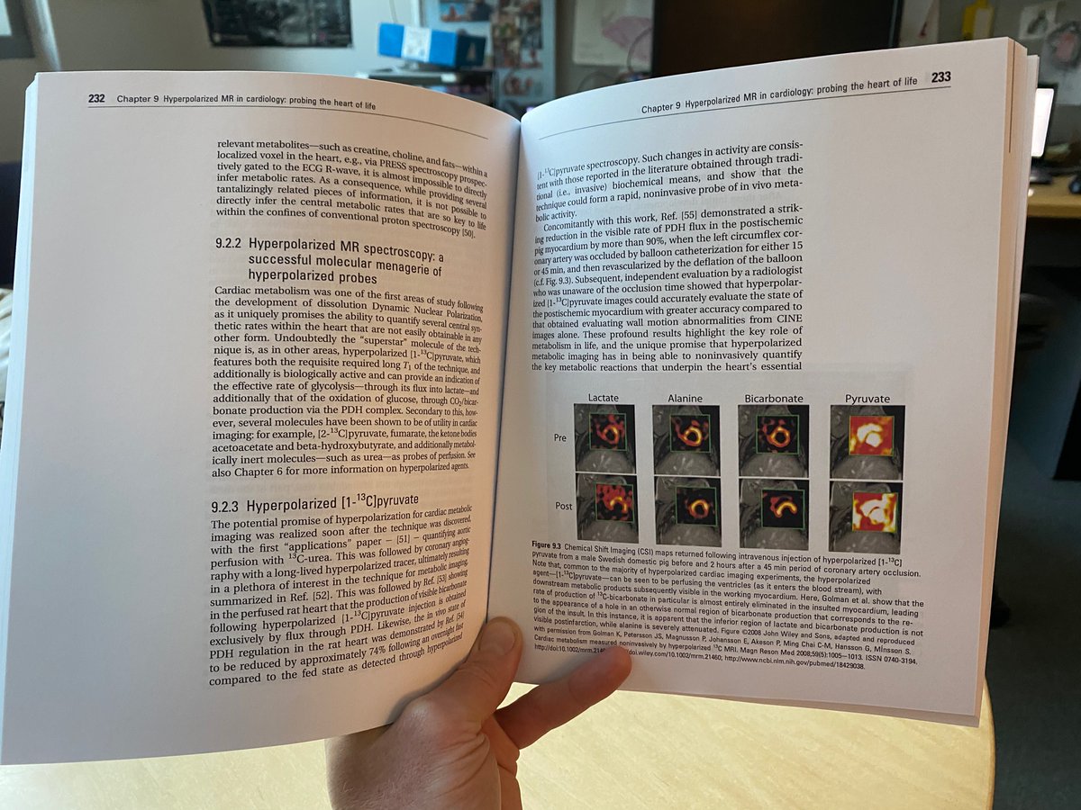 Peder Larson (@pezlarson) on Twitter photo Book on #hyperpolarized #MRI just out! Follows <a href="/UCSFimaging/">UCSF Imaging</a> course, aimed at new researchers
Not possible without amazing contributions @ardenkjaer <a href="/DrJackMiller/">Jack Miller</a> <a href="/Damian_Tyler/">Damian Tyler</a> <a href="/MichaelOhliger/">Michael Ohliger</a> <a href="/cvonmorze/">Cornelius von Morze</a> <a href="/UCSFHMTRC/">UCSF HMTRC</a> @jabankson <a href="/Dr_PViswanath/">Pavithra Viswanath</a> <a href="/DoctorMC_/">Myriam M. Chaumeil, PhD</a>
sciencedirect.com/bookseries/adv… Book on #hyperpolarized #MRI just out! Follows <a href="/UCSFimaging/">UCSF Imaging</a> course, aimed at new researchers
Not possible without amazing contributions @ardenkjaer <a href="/DrJackMiller/">Jack Miller</a> <a href="/Damian_Tyler/">Damian Tyler</a> <a href="/MichaelOhliger/">Michael Ohliger</a> <a href="/cvonmorze/">Cornelius von Morze</a> <a href="/UCSFHMTRC/">UCSF HMTRC</a> @jabankson <a href="/Dr_PViswanath/">Pavithra Viswanath</a> <a href="/DoctorMC_/">Myriam M. Chaumeil, PhD</a>
sciencedirect.com/bookseries/adv…