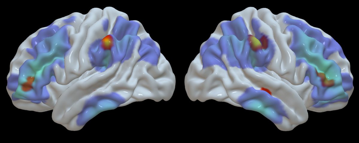 New research! Why do people with dementia have difficulty reacting to unexpected events? Here we demonstrate that the ‘multiple demand’ network for general intelligence co-ordinates the response of sensory brain regions when the environment changes: dx.doi.org/10.1523/JNEURO…