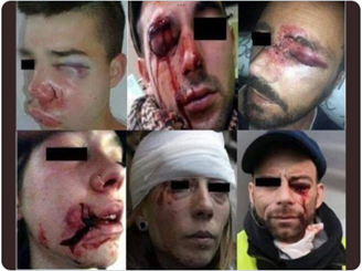 KampfDe's tweet photo. @JeudyBruno @IfopOpinion @ParisMatch Continuez à faire comme s'il n'était pas responsale de tout ces suicides, ces dépressions mm d'enfants de 6 ans, ces mutilés à vie : https://t.co/xSeAm8Q4Oz