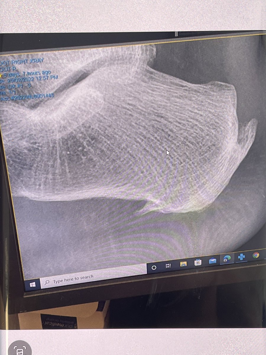 SoleMotionPod's tweet image. Looks like a good pair of heels … with the additional spurs!