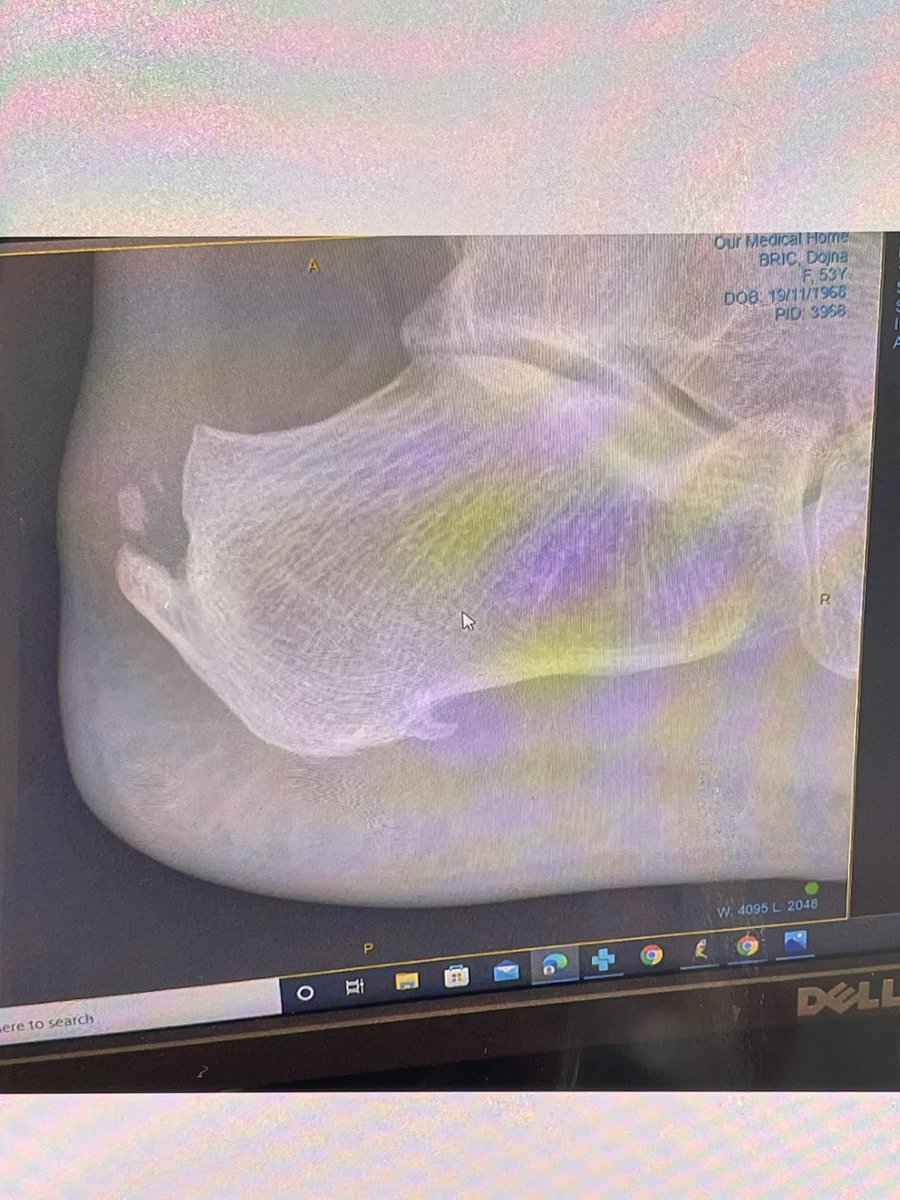 SoleMotionPod's tweet image. Looks like a good pair of heels … with the additional spurs!