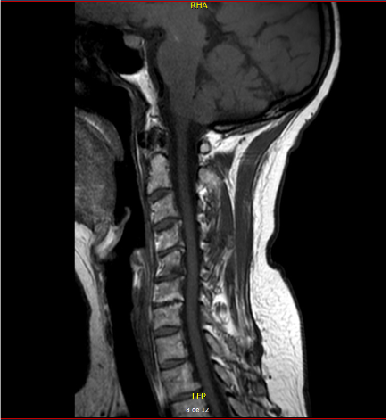 svmefr's tweet photo. Nuevo #casoclínicoweb:
“Fibromialgia, Parkinson y otras cosas como hipotensión”
https://t.co/gWrWeGoiXA
¡Enhorabuena a las autoras! https://t.co/LXhiPMRlJn