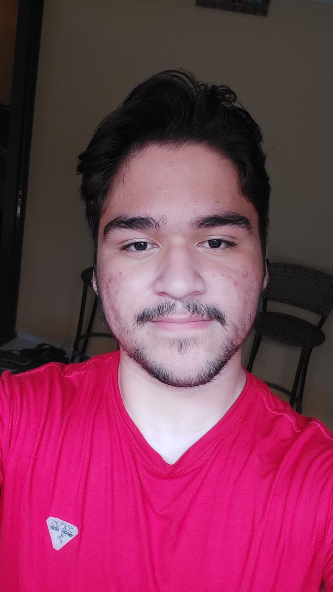 Cloretodeodio23's tweet photo. Meu tto com Isotretinoína/Roacutan
Dia 1:

Meu rosto tá bem oleoso, as espinhas são aquelas internas(mais pápulas do que pústulas), n costumam sair pus e demoram anos pra desaparecer. Obs: tenho dermatite seborreica (espero me livrar dela tbm)

To usando  o genérico, 20mg 2x/dia https://t.co/UsyrLmQzpu