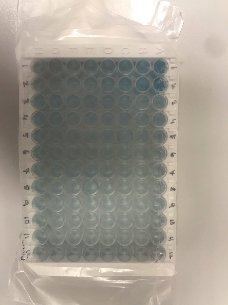 LoisSRoss's tweet photo. Celebrating international women’s day today by completing lab analysis for my final year project! https://t.co/Md7TgHNYXS