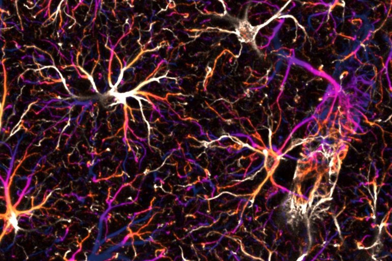 Astrocyte Networks in the Mouse Brain Control Spatial Learning and Memory

Network of astrocytes in the hippocampus of a mouse under the fluorescence microscope. Credit: Ladina Hösli, University of Zurich

#neuroscience #science

1/4

neurosciencenews.com/astrocyte-spat…