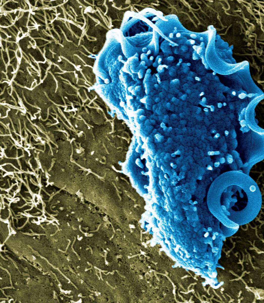 Arthur Mortha (@nkg2d1) on Twitter photo New work from #theonlylabever - online now! <a href="/J_Immunol/">The Journal of Immunology</a>
Here we report how the gut commensal protist Tritrichomonas musculis acts as "natural antibiotic" against enteric Salmonella infections. #proudPI
Share and RT.
We hope you'll find it interesting.
tinyurl.com/y4awtuzp New work from #theonlylabever - online now! <a href="/J_Immunol/">The Journal of Immunology</a>
Here we report how the gut commensal protist Tritrichomonas musculis acts as "natural antibiotic" against enteric Salmonella infections. #proudPI
Share and RT.
We hope you'll find it interesting.
tinyurl.com/y4awtuzp