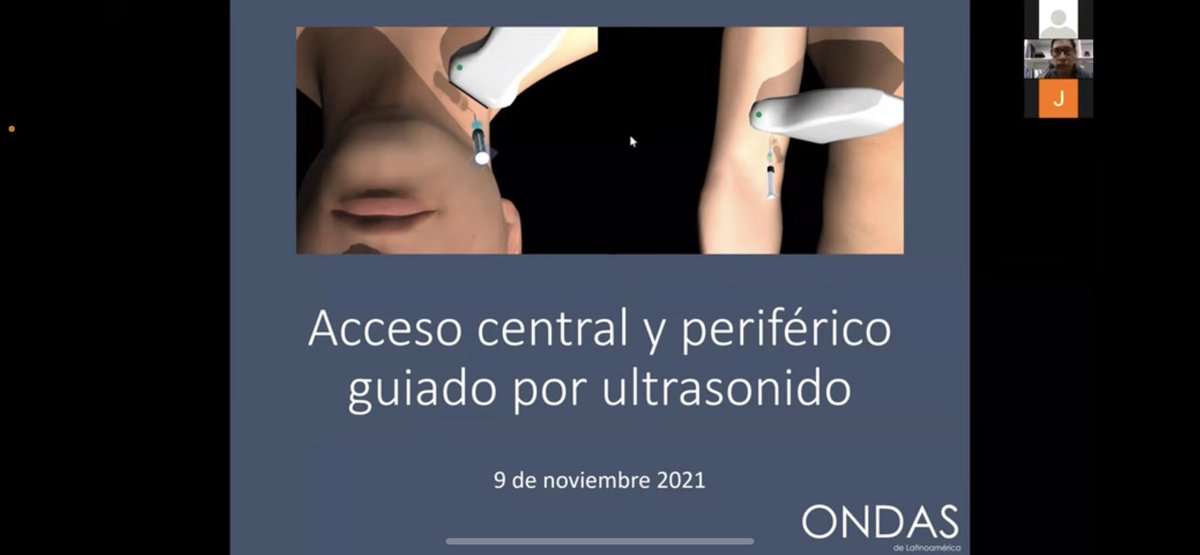ItaloVasquezMD's tweet photo. #08deMarzo ONDAS - Accesos vasculares. Dr Marco Guillén, Fellow Ultrasonido de EMG. 👉 https://t.co/nvcEuqhl9k 👉 vía @YouTube @marcosonocusco @DreyfussAndrea @Dmartin07EM @ondasPOCUS @UPAndo6 @JackelineEstof1 https://t.co/1gi80zJeGp