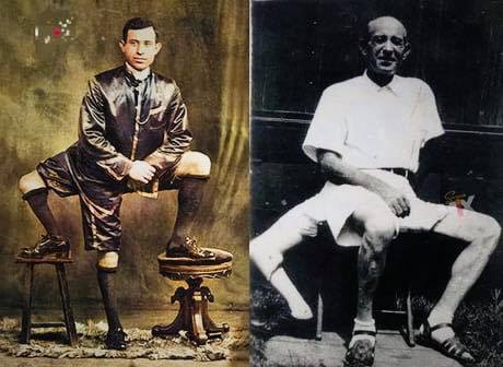 amzwold's tweet photo. Meet Frank Lentini, the Man with 3 legs...😮

Being #unique is a #superpower!

#amaxiom #amazingworld #amazing #photography #PhotoOfTheDay #AmazingPeople https://t.co/jsU2PIOJro