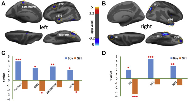 #JAACAP study found that higher prenatal maternal #depressivesymptoms predicted larger surface areas in the prefrontal cortex, superior temporal gyrus, and superior parietal lobe in boys, whereas, the opposite pattern was seen in girls. jaacap.org/article/S0890-…  <a href="/anqi_qiu/">Qiu Anqi</a>