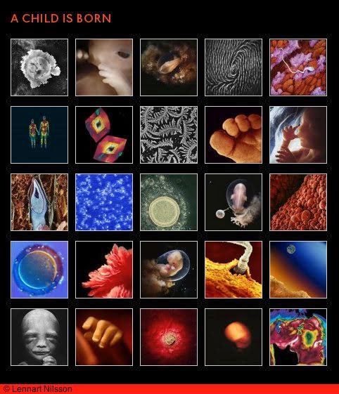 serprovidaofi's tweet photo. Te presentamos el trabajo del fotógrafo Lennart Nilsson, quien fotografió a diferentes niños no nacidos en la vida prenatal.

Estas fotos han logrado evidenciar la humanidad y belleza del ser humano en su etapa más vulnerable.

😍😍😍😍😍😍 https://t.co/L3WfFp3dXq