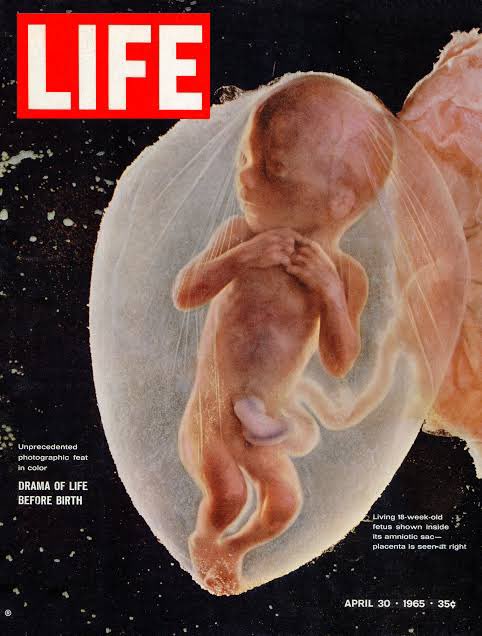serprovidaofi's tweet photo. Te presentamos el trabajo del fotógrafo Lennart Nilsson, quien fotografió a diferentes niños no nacidos en la vida prenatal.

Estas fotos han logrado evidenciar la humanidad y belleza del ser humano en su etapa más vulnerable.

😍😍😍😍😍😍 https://t.co/L3WfFp3dXq