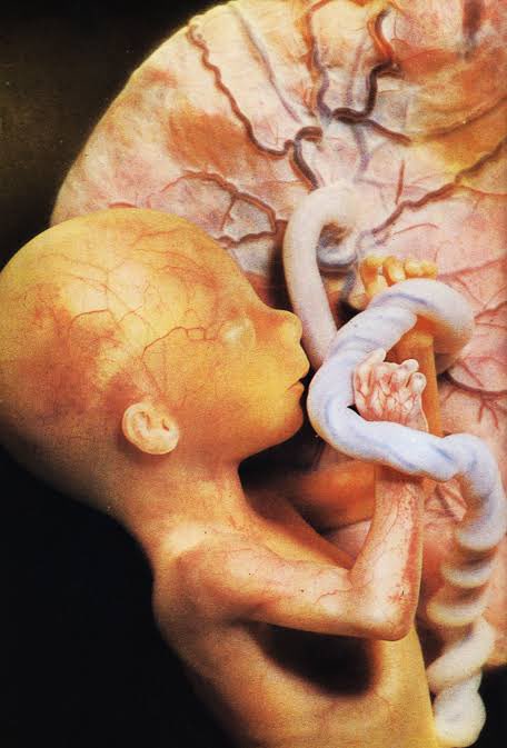 serprovidaofi's tweet photo. Te presentamos el trabajo del fotógrafo Lennart Nilsson, quien fotografió a diferentes niños no nacidos en la vida prenatal.

Estas fotos han logrado evidenciar la humanidad y belleza del ser humano en su etapa más vulnerable.

😍😍😍😍😍😍 https://t.co/L3WfFp3dXq