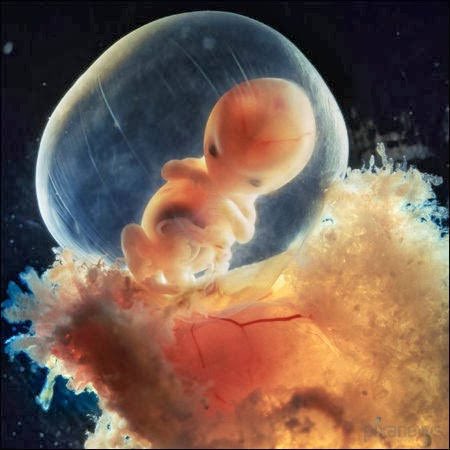 serprovidaofi's tweet photo. Te presentamos el trabajo del fotógrafo Lennart Nilsson, quien fotografió a diferentes niños no nacidos en la vida prenatal.

Estas fotos han logrado evidenciar la humanidad y belleza del ser humano en su etapa más vulnerable.

😍😍😍😍😍😍 https://t.co/L3WfFp3dXq