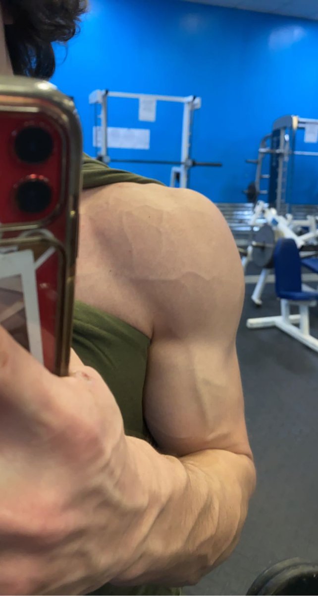 marloweee7's tweet photo. 🕷 Shoulder veins incoming;)) https://t.co/b7Olw14ZzA