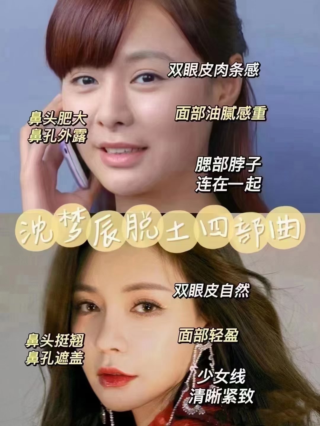 泫然呀 医美私我 沈梦辰整的还是很成功的丨下颌缘吸脂 脸和脖子的界限一定要清晰不仅瘦脸还很减龄 医美