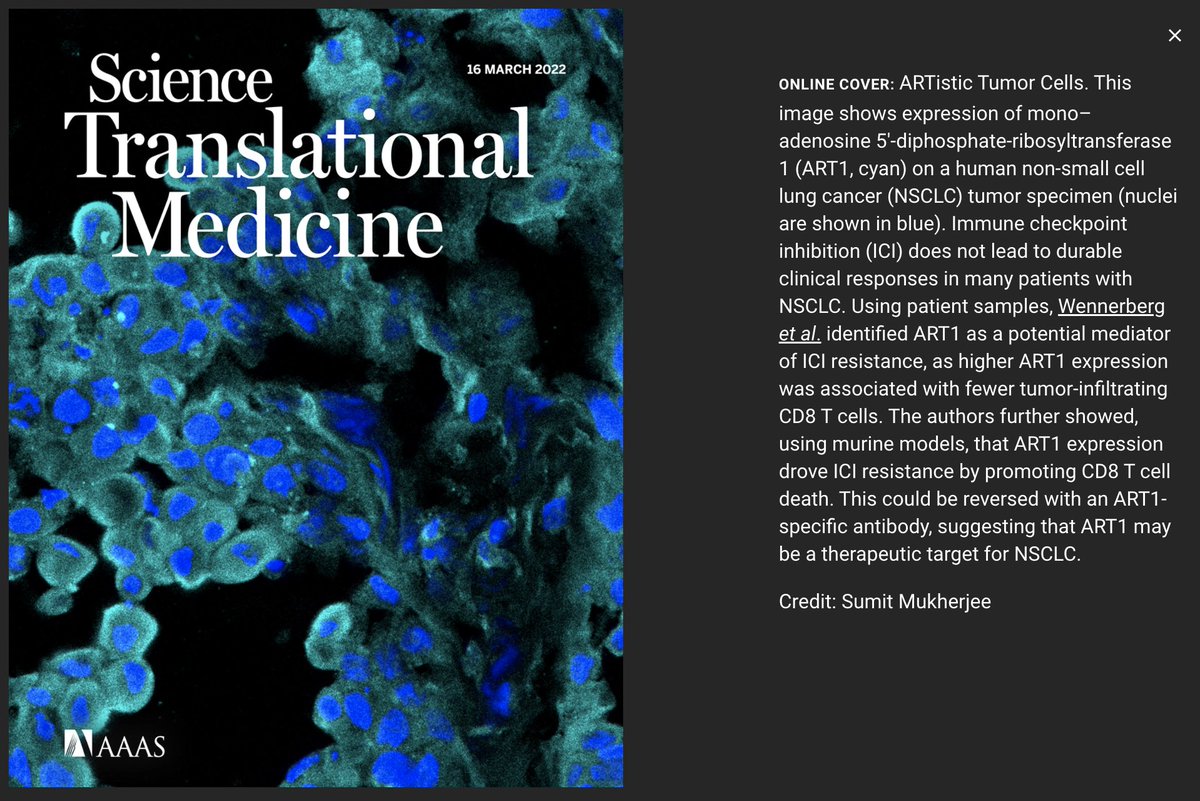 Brendon Stiles (@brendonstilesmd) on Twitter photo Thrilled and proud to announce that our lab paper is the cover article today in <a href="/ScienceTM/">Science Translational Medicine</a>! Congratulations to co-first authors @erik_wennerberg at <a href="/ICR_London/">The ICR</a> and <a href="/mukherjee0886/">Sumit Mukherjee, Ph.D. / সুমিত মুখোপাধ্যায়</a> at <a href="/EinsteinMed/">Albert Einstein College of Medicine - Official</a>. This was an incredible effort and journey. Hope you can read the thread below. Thrilled and proud to announce that our lab paper is the cover article today in <a href="/ScienceTM/">Science Translational Medicine</a>! Congratulations to co-first authors @erik_wennerberg at <a href="/ICR_London/">The ICR</a> and <a href="/mukherjee0886/">Sumit Mukherjee, Ph.D. / সুমিত মুখোপাধ্যায়</a> at <a href="/EinsteinMed/">Albert Einstein College of Medicine - Official</a>. This was an incredible effort and journey. Hope you can read the thread below.