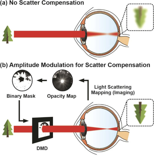 pablo_artal's tweet photo. New paper just published in #BiomedicalOpticsExpress
@OpticaPubsGroup @OpticaWorldwide
"Intraocular scatter compensation with spatial light amplitude modulation for improved vision in simulated cataractous eyes"
@lo_um @umu🇪🇸
@UMK_Torun 🇵🇱
https://t.co/NPy7V8uI5q https://t.co/eoP4KlLFKp