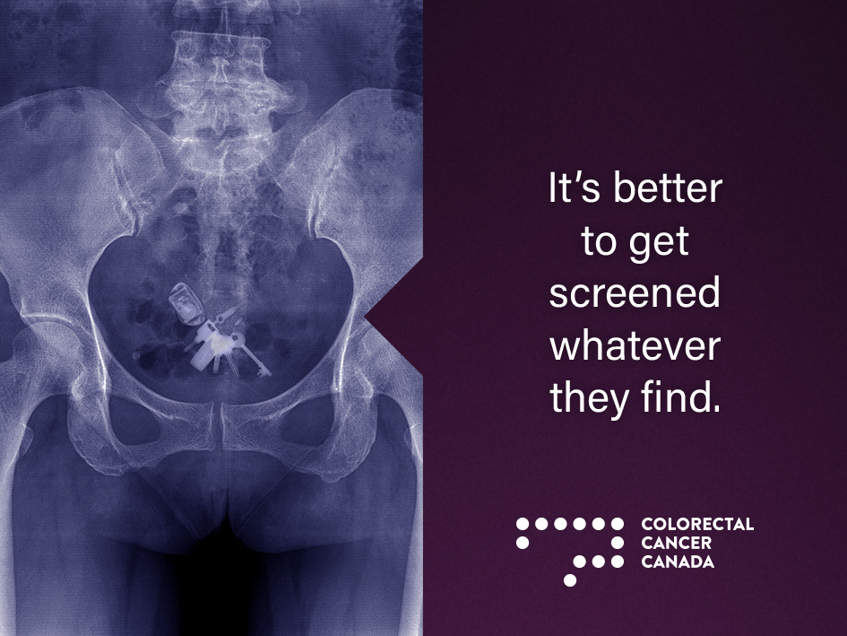 CANO_ACIO's tweet photo. March is #ColorectalCancerAwarenessMonth! #crc is one of the most commonly diagnosed cancers in Canada. Check out @coloncanada for more info about #colorectalcancer & resources available for patients across Canada. #marchtogetscreened #marchawarenessmonth #canoacio https://t.co/BGHAxzplQb