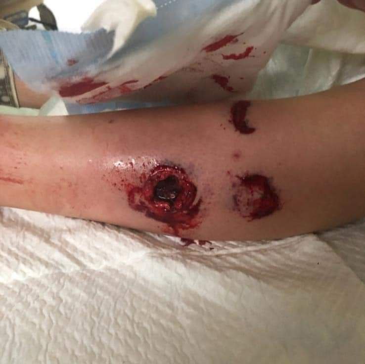 MLC_infos's tweet photo. Non ce n'est pas les images de #RussiaUkraineWar mais bien de la répression policière en #France.
20 lycéens blessés dont 6 par des tirs de LBD.
Ce mardi à #Ajaccio, plus de 300 lycéens se sont mobilisés contre l’agression du militant #corse Yvan #Colonna le 3 mars dernier. https://t.co/vP6G7PRWAc