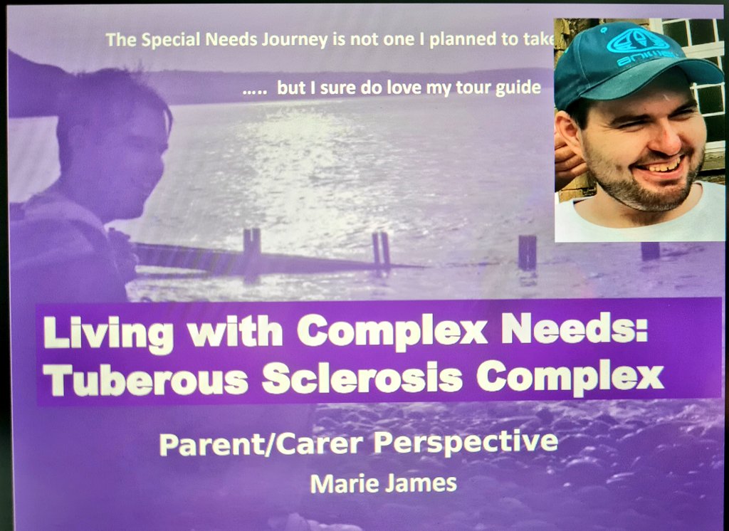 WalesGenePark's tweet photo. Diolch yn fawr/thank you to inspirational #RareDisease patient advocate @PMTJames for talking to @USWCareSciences students about her family's experiences of #tuberoussclerosis at the Living Well with Long Term Conditions session with @emmattonkin @USW_GPU. So powerful &amp; vital 🧬 https://t.co/gavzrdbG3W