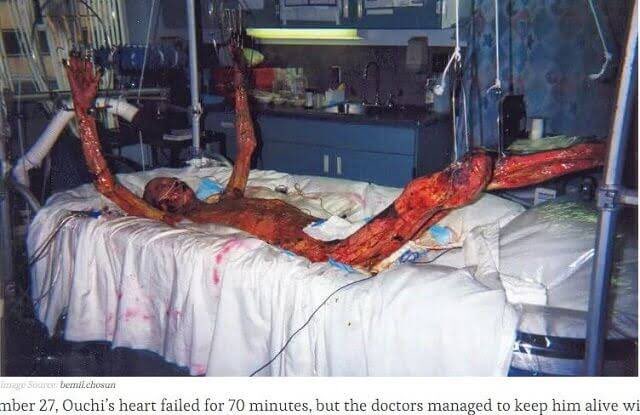 Russiastop1's tweet image. @Russia
Не глупи‼️
Не выключайте питание Чернобыльской АЭС‼️
Произойдет сбой!  При воздействии радиации тело плавится, как показано на фото.  Не будет играть‼️

Охладите топливные стержни сейчас‼️

#StandWithUkraine #StopRussianAggression

#follow #RT #emergency