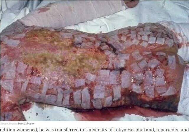 Russiastop1's tweet image. @Russia
Не глупи‼️
Не выключайте питание Чернобыльской АЭС‼️
Произойдет сбой!  При воздействии радиации тело плавится, как показано на фото.  Не будет играть‼️

Охладите топливные стержни сейчас‼️

#StandWithUkraine #StopRussianAggression

#follow #RT #emergency