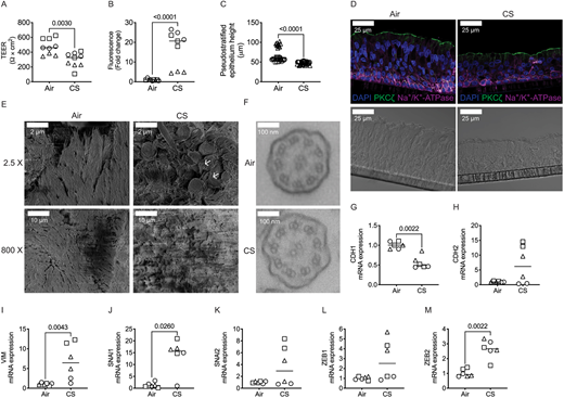 J_Cell_Sci's tweet photo. The article by Ghosh @bghosh226, Nishida et al. @sidhayelab @JohnsHopkinsSPH showing that epithelial plasticity in COPD results in cellular unjamming due to an increase in polymerized actin is #openaccess: https://t.co/ArFh8eTtRD https://t.co/Jj2Y3RcI0X