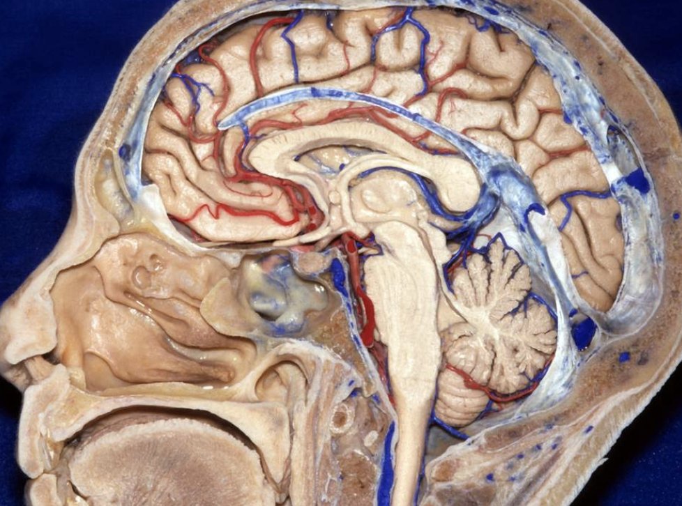 cvsection's tweet photo. In a #midsagittal dissection, you can see the trajectory of the #pericallosal and #callosomarginal arteries after branching off of the #ACA. #Cerebrovascular #Neuroanatomy Source: Neurosurgical Atlas & Rhoton. https://t.co/7Krgu5QMp4 https://t.co/qMb4kT78Dy