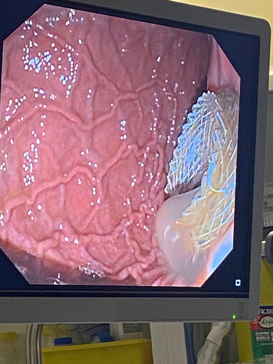 alexiaoligarca's tweet photo. Hoy Axios ✅; médico feliz 👩‍⚕️🤓😁 https://t.co/QTskBhrdh2