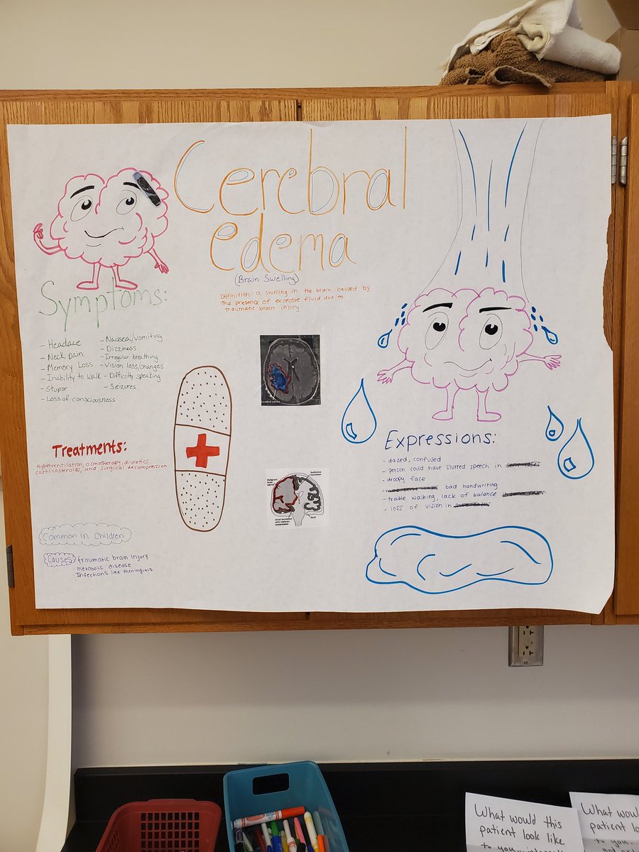 yankeeraider81's tweet photo. What would a patient look like (internally and externally) if they were in front of you with a TBI or CVA? My A&amp;P students will show you with their Clinical Performance Posters and gallery walk...designing, learning, and taking their own notes! #kkidsalwayslearning https://t.co/TvMXREHRCv