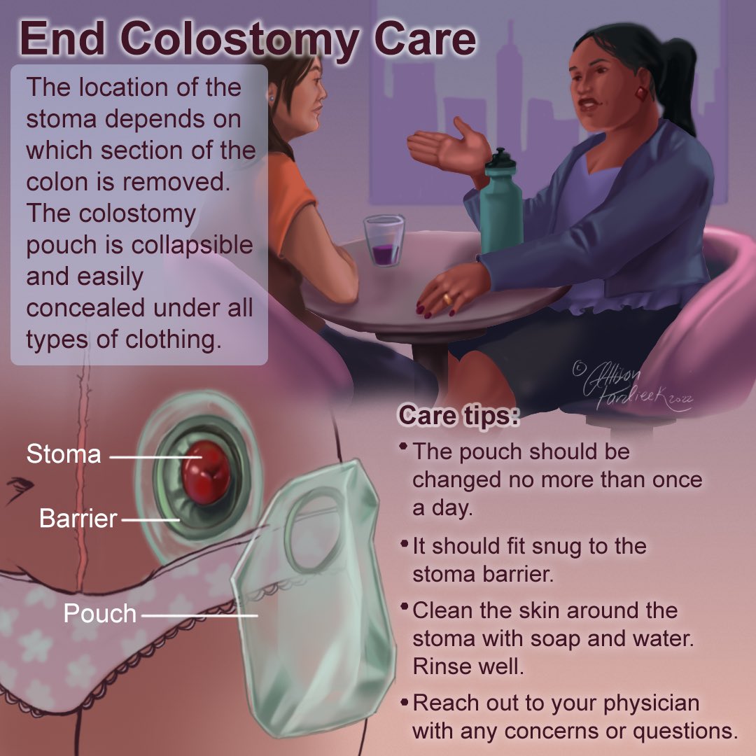 illustrallison's tweet photo. Colostomy procedure and care  #medart https://t.co/l3c0cbwuet