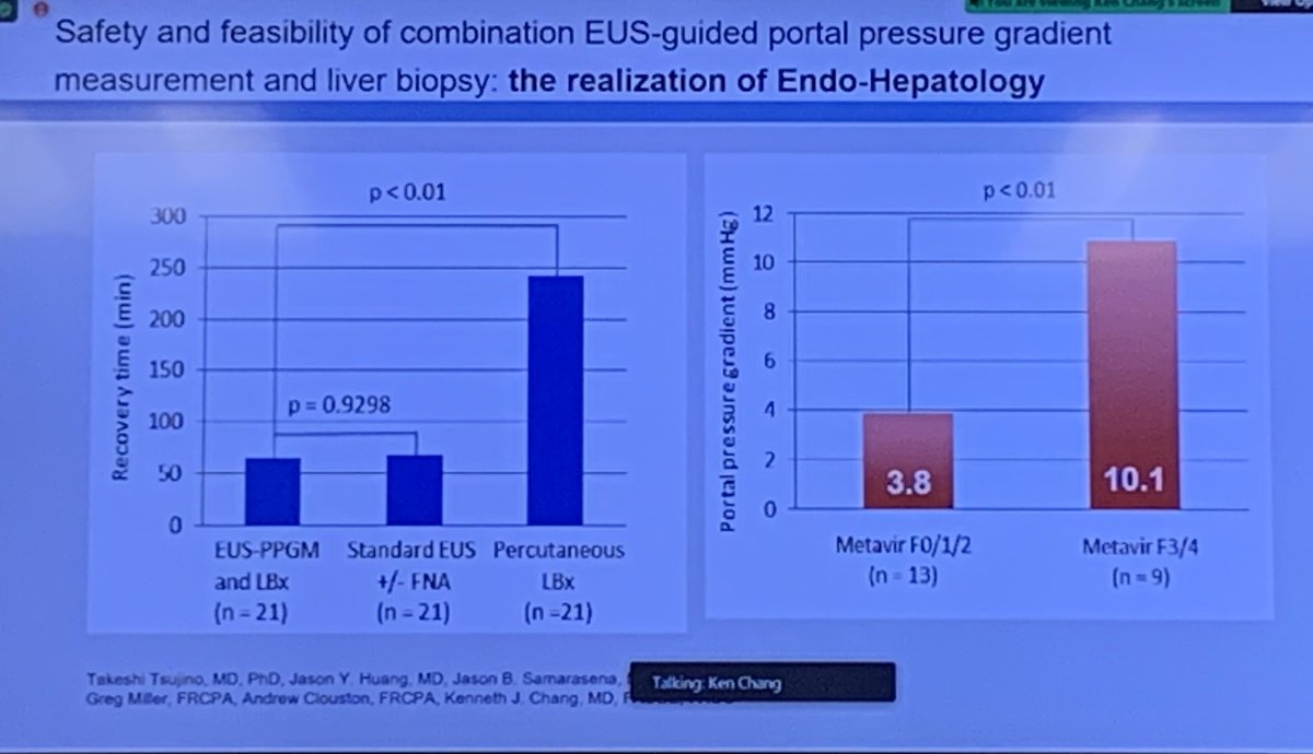 LizzieAbyMD's tweet photo. Great lecture by Dr. Kenneth Chang on #endohepatology &amp; #EUS guided portal pressure measurements

Presented a case of EUS guided HVPG measurements for use in the diagnosis of pre-sinusoidal portal HTN

Curious when others reach for EUS portal pressure measurements🤔
#LiverTwitter https://t.co/OlgXl4AV3f