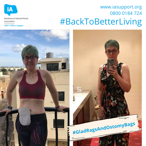 iasupport's tweet photo. Share your #GladRagsAndOstomyBags like Emma Goodridge-Hobson did in our 2019 campaign! "Had my bag 18 months. Saved my life. Now a competitive runner &amp; will not let Crohn’s beat me 👍💪" 

Be part of our 2022 campaign, PM us your gladrags &amp; ostomy photos.

#BackToBetterLiving https://t.co/706aFHmbol