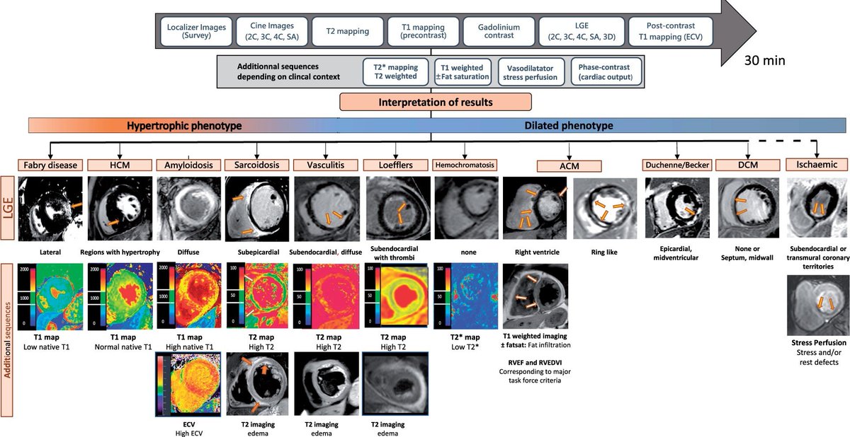 SeguraCardio's tweet photo. 📌#HowTo evaluate #cardiomyopathies by #WhyCMR parametric mapping &amp; late gadolinium enhancement 
#CardioEd #CardioTwitter https://t.co/zBVhcdxaBM