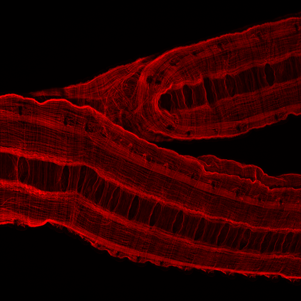 _lauren_k__'s tweet photo. Immunolabelled my 2-tailed worm! Green=Nervous system &amp;Ventral Nerve Cord (VNC), Red=Muscle, Blue=Nuclei. Separation of the 2 VNCs surprised me! What happened here? 🤔#wormwednesday! https://t.co/NqAsv14C18